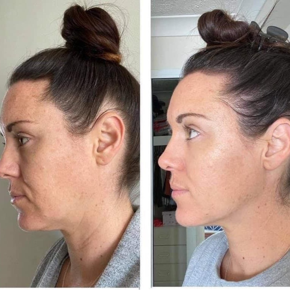 COPY - Collagen Elixir - Picture 8 of 11